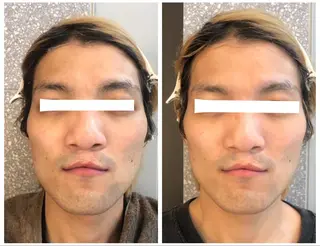 Leading Ladiesのエステ・リラクイメージ