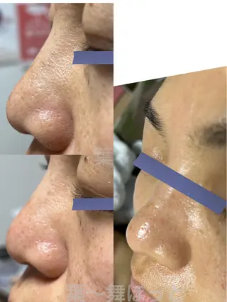 うえつま ふみえのエステ・リラクイメージ