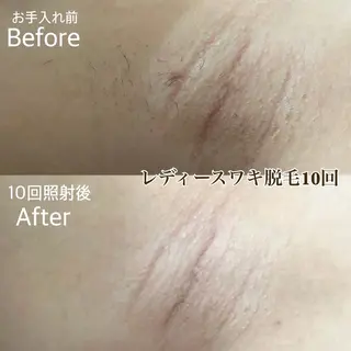 MINOA熊本店所属・MINOA 熊本店のエステ・リラクイメージ