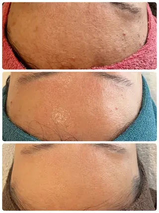 Dione八王子店所属・LUKE （ルーク）のエステ・リラクイメージ