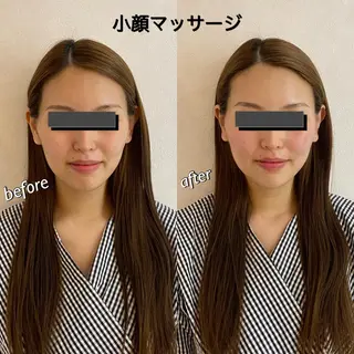 うなじ脱毛/美肌脱毛 LABELのエステ・リラクイメージ