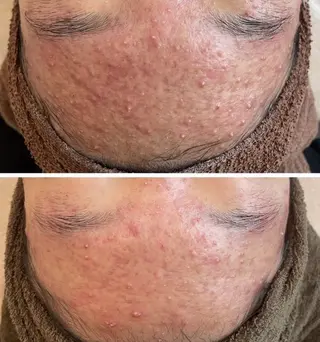 月のあかり所属・オイル&フェイシャル 【月のあかり🌙】のエステ・リラクイメージ