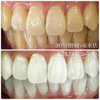 PLATINUM Beauty 横浜店所属・ホワイトニングルーム 横浜店のその他イメージ