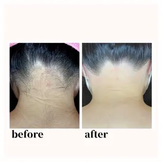 脱毛エステサロンViViPirina所属・軽部 歩のエステ・リラクイメージ