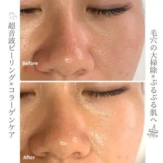 姫路/肌質改善 /やまもとのエステ・リラクイメージ