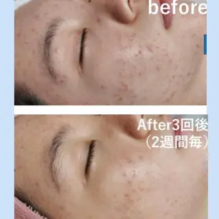 Mia.rosa所属・光フェイシャル・脱毛 MIA.ROSAの眉毛・アイブロウイメージ