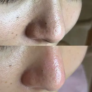 毛穴ケア・ヘッドスパサロンSHINY(シャイニー)所属・毛穴ケア・ヘッドスパ サロンSHINYのエステ・リラクイメージ