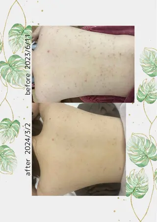 ベルーテ エッセンスのエステ・リラクイメージ