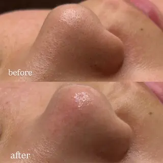 レアエイト所属・lea'8 lea'8のエステ・リラクイメージ