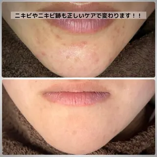 Muqu.所属・Muqu. 毛穴サロンのエステ・リラクイメージ