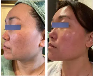 フェイシャルサロン N +〜エヌプラス〜のエステ・リラクイメージ