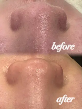 ぷる艶肌🫧 shaving斉藤のその他イメージ