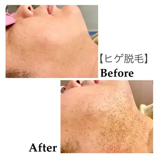 メンズ 脱毛サロンFIS【新宿店】所属・堺 祐季奈のエステ・リラクイメージ