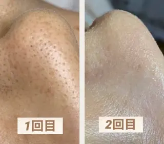 Facial Salon LUIRE所属・LUIRE　 ルイールのエステ・リラクイメージ