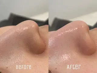 ニキビ・毛穴・肌荒れ &me 西宮北口店のその他イメージ