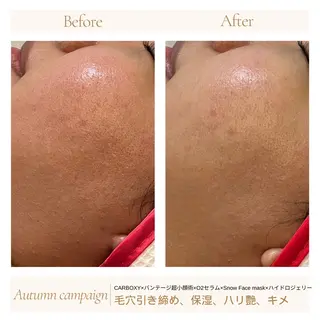 1ヶ月後も半分残る 高持続LEDエクステのマツエク・マツパデザイン