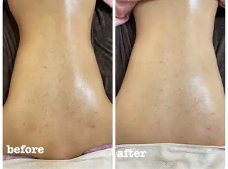 肌質改善専門店/絹々(きぬ)所属・心満たされる ハーブピーリング絹々のエステ・リラクイメージ