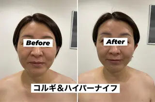 リュー・.ド・ボウテ所属・肌質改善サロン★ リュー・ド・ボウテのエステ・リラクイメージ