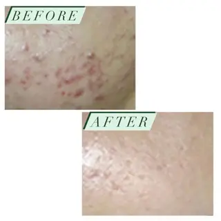 ハーブピーリング・毛穴ケア専門サロンSalon de LENA所属・ハーブピーリング 専門店/名古屋駅前店のその他イメージ