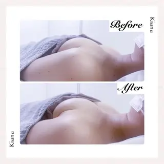 【バスト専門店 】 Kiana のエステ・リラクイメージ