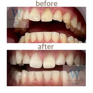 ホワイトニング ショップ船橋２号店のエステ・リラクイメージ