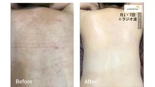 Hopeful Glowのエステ・リラクイメージ