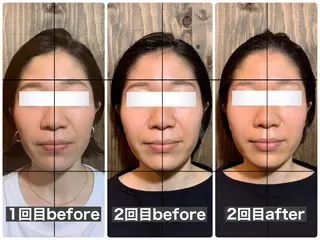 💎後悔させない小顔 矯正💎イトヤマ🌱のエステ・リラクイメージ