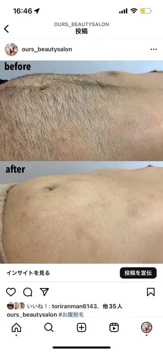 メンズ 瀬戸 梨子のエステ・リラクイメージ