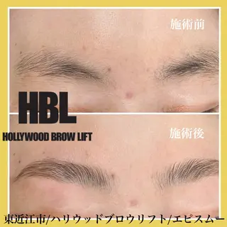 アイブロウ epismoo 脱毛/HBL/毛穴の眉毛・アイブロウイメージ