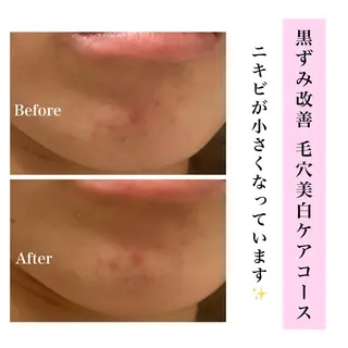 Bellesthe (ベルエステ)のエステ・リラクイメージ