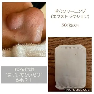 毛穴ケア・肌質改善 徳川のエステ・リラクイメージ