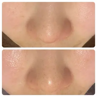 Lussera(ルセラ)所属・肌質を変えて すっぴん肌に✨のその他イメージ