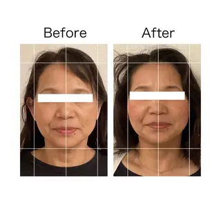 小顔サロンSharp …腸調整よもぎ蒸しのエステ・リラクイメージ