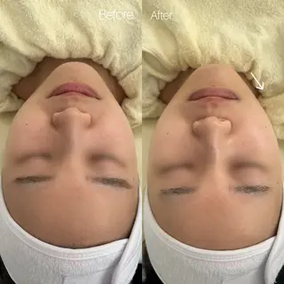 〈etre〉トータルビューティーサロン所属・etre - 韓国肌管理 -のエステ・リラクイメージ