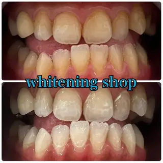 ホワイトニング ショップ吉祥寺店のエステ・リラクイメージ