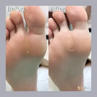 巻き爪補正店 大阪天王寺店のネイルデザイン