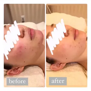 美肌脱毛専門サロン Dione栄店のエステ・リラクイメージ