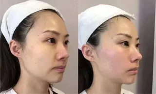 ネイル aliaハイフ&水光ジェットサロン所属・aliaハーブ水光店 エステティシャン募集のエステ・リラクイメージ