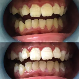 beauty salon Plumeria所属・河田 裕美のエステ・リラクイメージ