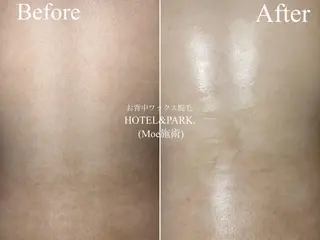 HOTEL&PARK . ワックス脱毛のエステ・リラクイメージ
