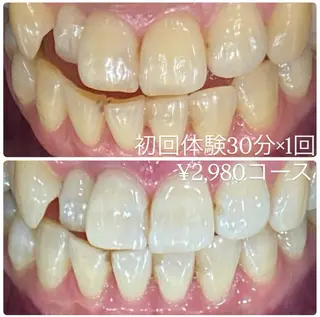 PLATINUM Beauty 横浜店所属・ホワイトニングルーム 横浜店のその他イメージ