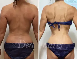 private salon  Dea_maris シュガーリング＆パーソナルボディケア所属・シミ改善・韓国肌管理 ボディメイク痩身のその他イメージ