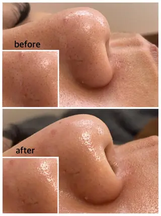 韓国肌管理 【毛穴専科】のエステ・リラクイメージ