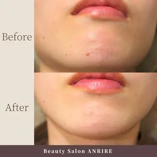 ANRIRE (アンリール)のエステ・リラクイメージ