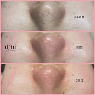uni. beautyのエステ・リラクイメージ