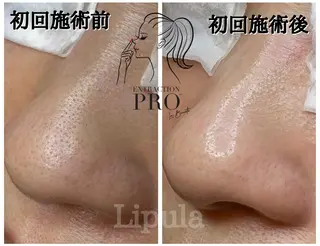 Lipula リプラ所属・毛穴ツヤ肌専門    Lipulaのエステ・リラクイメージ