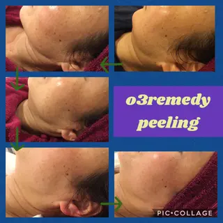 o3remedy所属・宇野澤 彩加のエステ・リラクイメージ