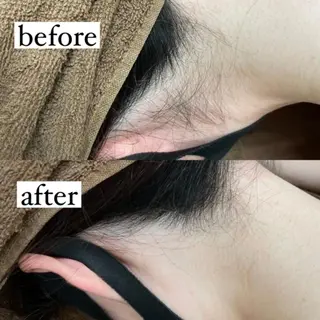 RinRin 甲府店のエステ・リラクイメージ