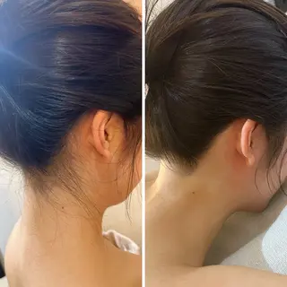 うなじ脱毛/美肌脱毛 LABELのエステ・リラクイメージ