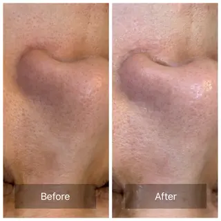 facial aesthetic salon SENTEUR所属・美肌改善/毛穴/シミ サントゥールのエステ・リラクイメージ